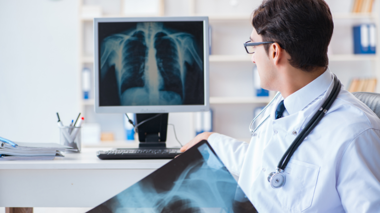 Managing other findings in lung cancer screening: survey highlights urgent need for international guidelines