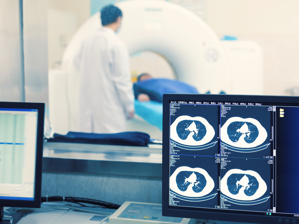 A patient undergoing a CT scan while lying on a scanning table that moves into a large circular CT scanner. In the foreground, a computer monitor displays cross-sectional images of the patient’s lungs. A healthcare professional in a white coat stands near the scanner, overseeing the procedure.