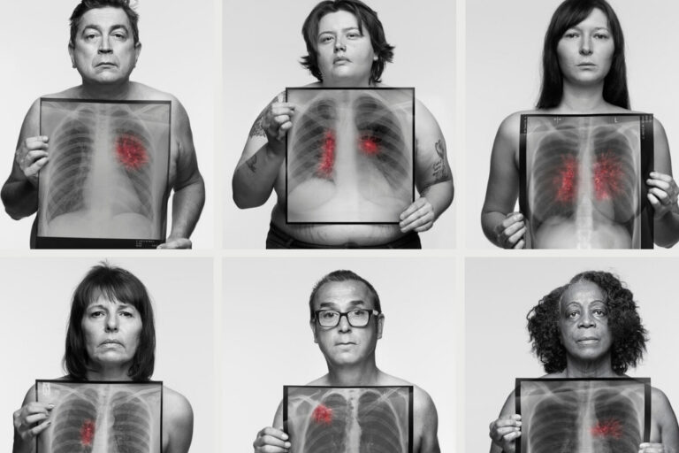 ‘See Through the Symptoms’ campaign returns to support earlier diagnosis